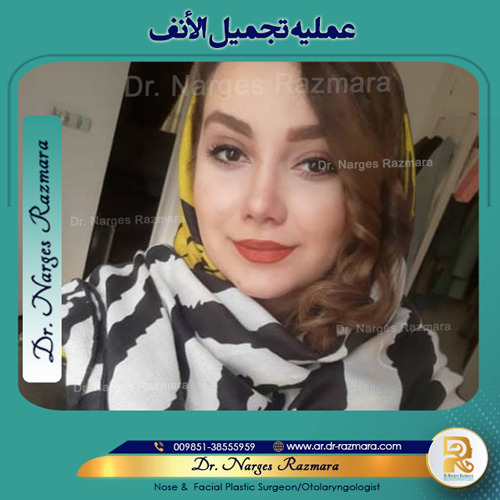 عملیه الانف الثانویه